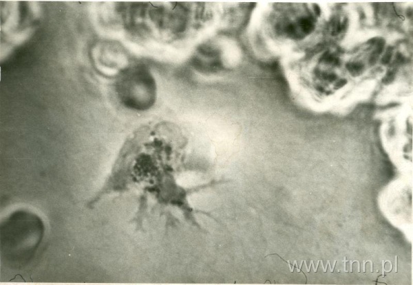 Pełzający leukocyt - widok z mikroskopu Ludwika Flecka